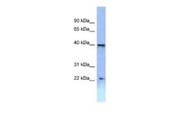 HOXA2 Rabbit anti-Human, Polyclonal, Novus Biologicals 0.1 mL | Buy Online | Novus Biologicals | Fisher Scientific
